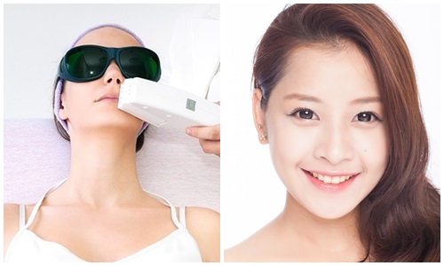 địa chỉ triệt lông mặt tốt nhất