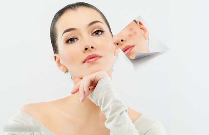điều trị mụn sưng viêm tại hà nội