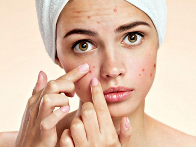 điều trị mụn sưng viêm bằng công nghệ Elight