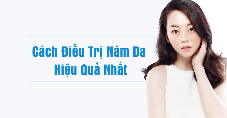 phương pháp điều trị nám hỗn hợp hiệu quả