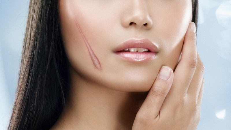  dieu trị seo hieu qua