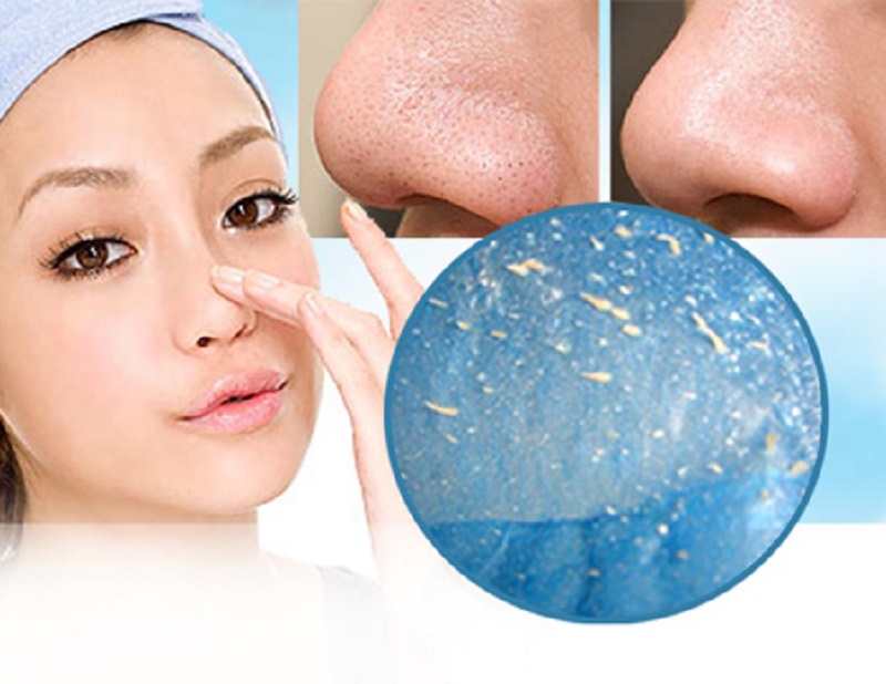 điều trị mụn cám tại spa