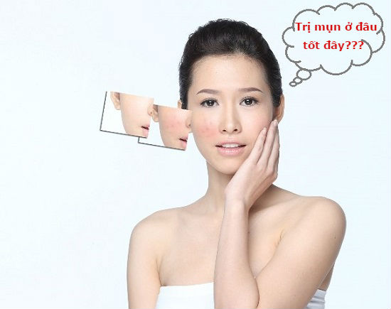 điều trị mụn ở đâu hà nội