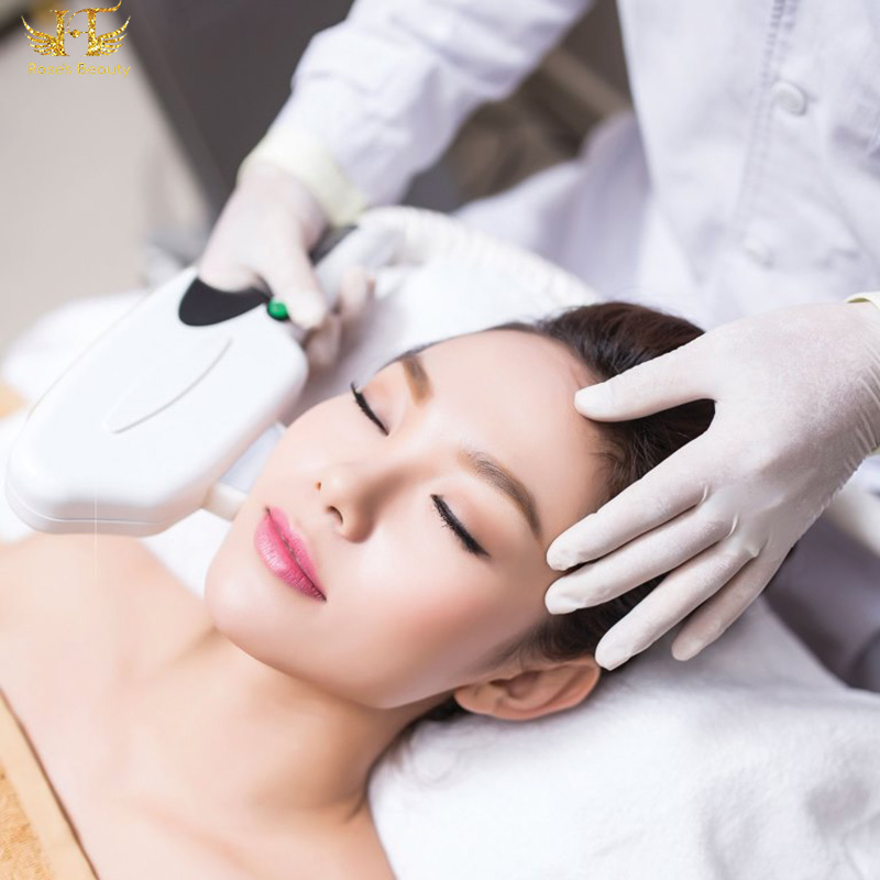 Triệt lông mặt vĩnh viễn