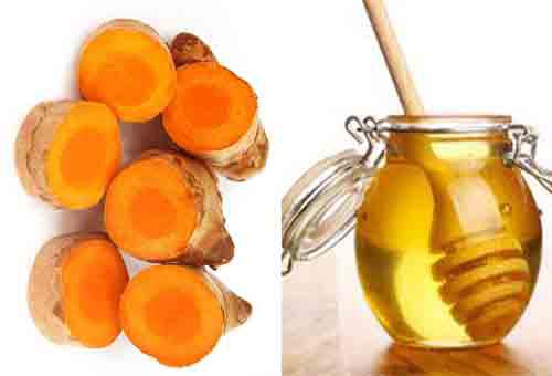 Trị nám da bằng nghệ tươi và mật ong