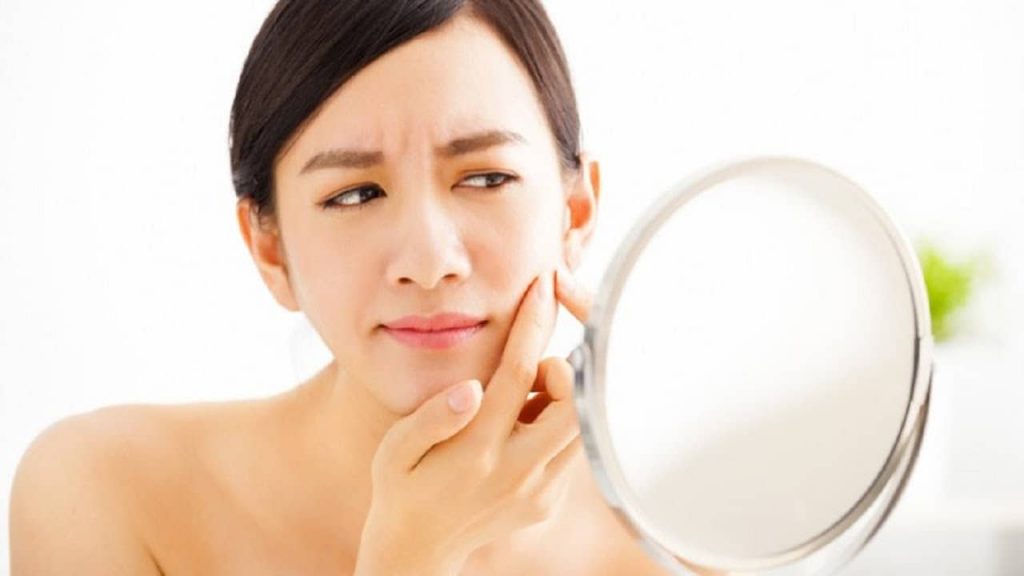 cách trị mụn trứng cá