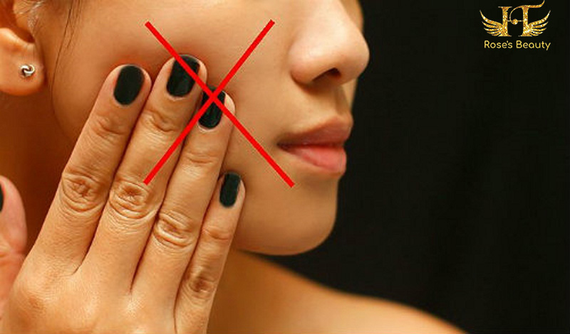ngăn ngừa mụn trứng cá