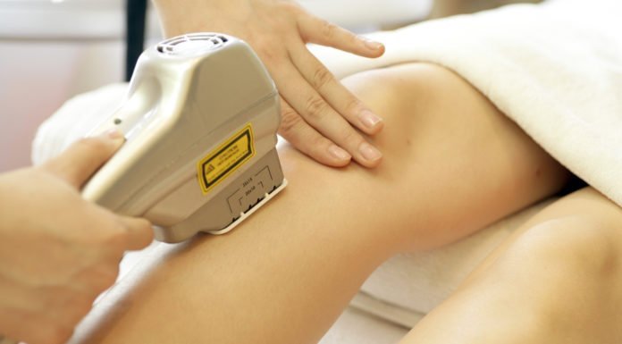 triệt lông đơn giản mà lại hiệu quả