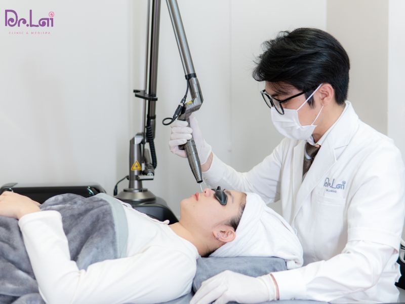 Ưu điểm của trị thâm mụn bằng tia laser
